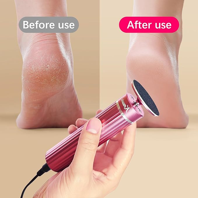 5.3'' Electric Foot Callus Remover with 80pcs Sandpaper Discs & Brush, Professional Aluminum Ergonomic Pedicure Tool, Stepless Speed & Reverse Control for Dead Skin Removal (Pink)-Velvo Beauty