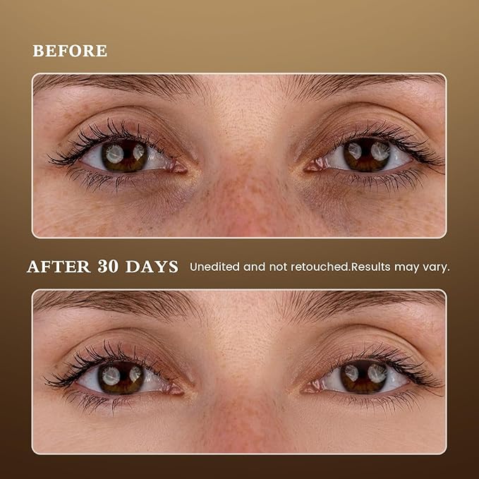 Puffy Eyes Smoothing Under Eye Patches, Caffeine Eye Masks for Wrinkles and Dark Circles, Undereye Bags, Brightening Skincare Treatment for Men & Women, Vegan & USA Tested-Velvo Beauty