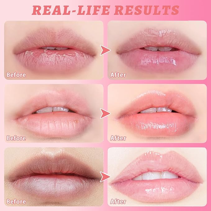 3 Pcs Honey Lip Balm, Bee Lip Balm Honey Pot,Moisturizing Lip Mask Overnight,Hydrate Repair Prevent Dry Cracked Lip Care (Honey+Strawberry+Watermelon)-Velvo Beauty