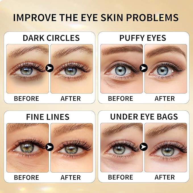 ROUSE Under Eye Patches (20 Pairs), 24K Gold Collagen Anti-Wrinkle Eye Mask Golden Anti-Aging Smooth Eye Pads for Dark Circles Puffy Eyes Moisturizing Nourishing-Velvo Beauty