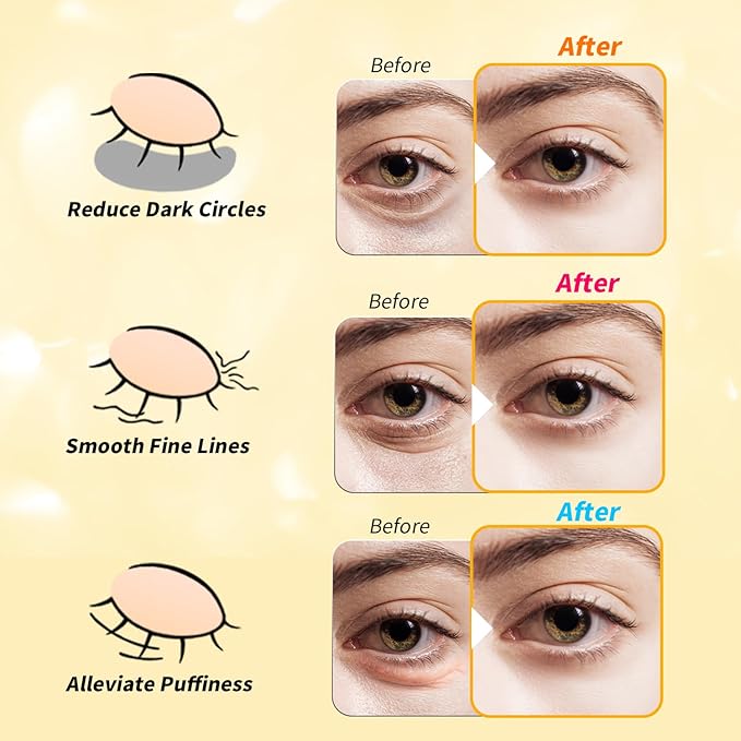 Under Eye Patches(48 Pairs), 24K Gold, Caffeine, Retinol Eye Masks for Puffy Eyes, Wrinkles, Dark Circles, Undereye Bags Treatment - Restoring & Awakening & Moisturizer Skin care Gift for Women-Velvo Beauty