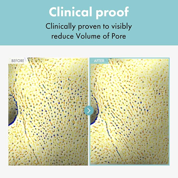 Pore Refiner Cream, Face Cream, Pore Extractor, Pore Minimize & Reducer and Remover. Best Pore Minimizer Treatment. Moisturizer for Oily Skin. K Beauty, Korean Skincare, 50g, 1.76 oz.-Velvo Beauty