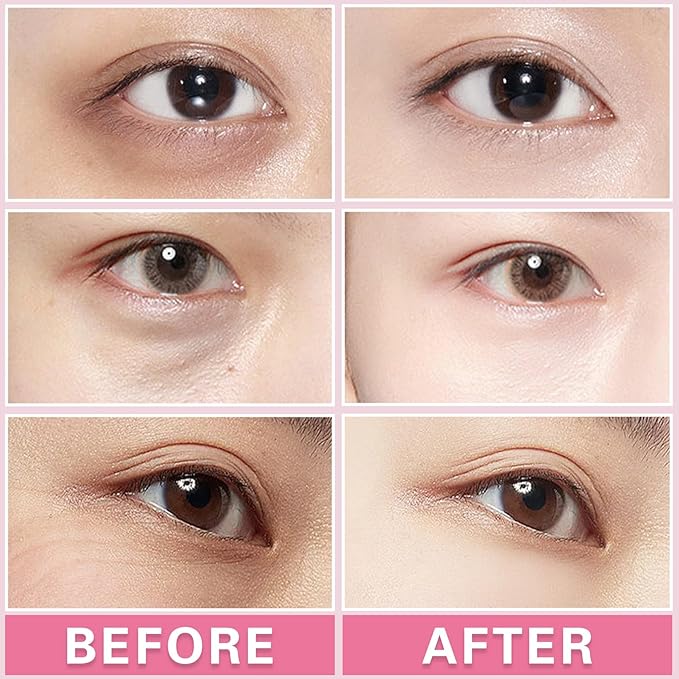 2PCS Under Eye Cream Lift Firm Skin Around the Eyes-Velvo Beauty