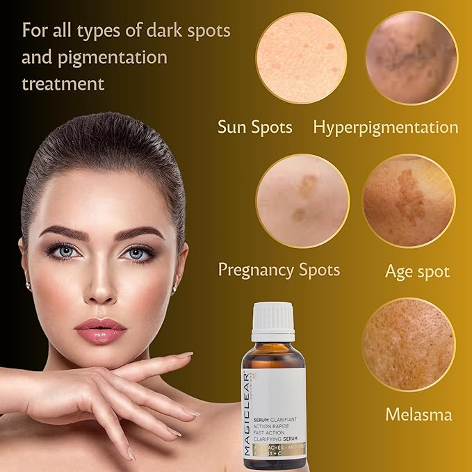 Luxury Swiss Dark Spot Remover for Face and Body Serum Gel Cream Age Sun Brown Spot Acne Freckles Corrector Melasma treatment Anti aging Skin Vitamin C + Niacinamide best organic brand Magiclear-Velvo Beauty