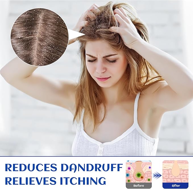 HIQILI 1000ML Rosemary Oil for Hair Growth, Add to Shampoo & Conditioner, 100% Pure Undiluted - 32 Fl Oz-Velvo Beauty