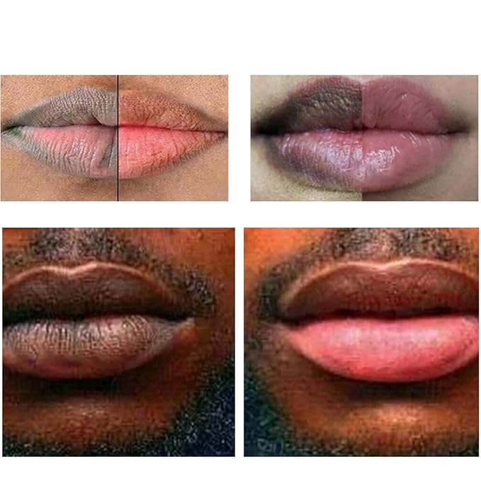 2pcs Lip Lightening for Dark Lips Lip Brightener for Smokers Dark Lip Treatment Lightening Cream for Pink Lips Lip Lightener for Smoker Lips Lip Lightening balm for Men and Women (Red)-Velvo Beauty