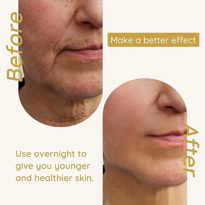 Enaskin Naturals Anti Wrinkle Face Patches Anti Wrinkle Gel Face Masks (1 Pack)-Velvo Beauty