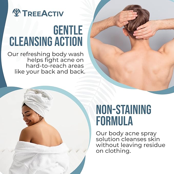 TreeActiv 90-Day Body Acne Treatment Kit, Salicylic Acid Acne Body Spray, Exfoliating Body Acne Wash, Body Acne Treatment for Back, Chest and Butt Acne Removal, Back Acne Treatment For Women and Men-Velvo Beauty