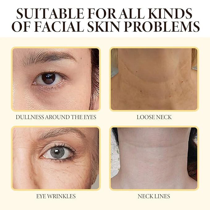 Bee Venom SkinCare Set, Includes New Zealand Bee Venom Face Lotion, Bee Venom Essence, Bee Venom Face Cream, Bee Venom Eye Cream, Anti-Wrinkle, Hydrating & Firming, Plant-Based Formula-Velvo Beauty