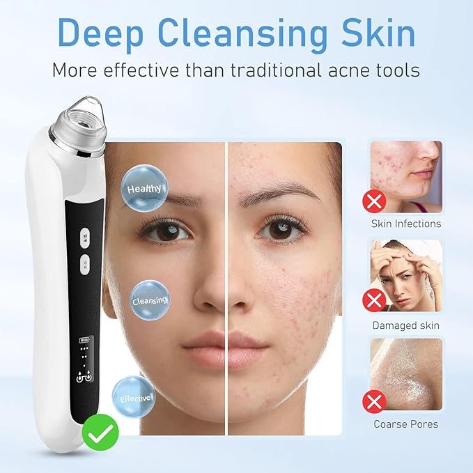 Facial Pore Blackhead Remover Vacuum, 1080P Camera Blackhead Remover, 20x Zoom, 8 LEDs ＆ 3 Suction Modes, 800mAh Battery & USB - 6 Heads Pore Cleaner Kit for Women&Men(Black)-Velvo Beauty