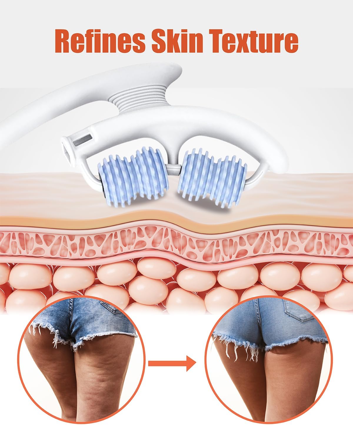 Anti Cellulite Roller & Lymphatic Drainage Massager | Fascia Blaster for Contoured & Smoother Skin | Tool for Sore Arms, Legs, Stomach & Buttocks (Blue)-Velvo Beauty