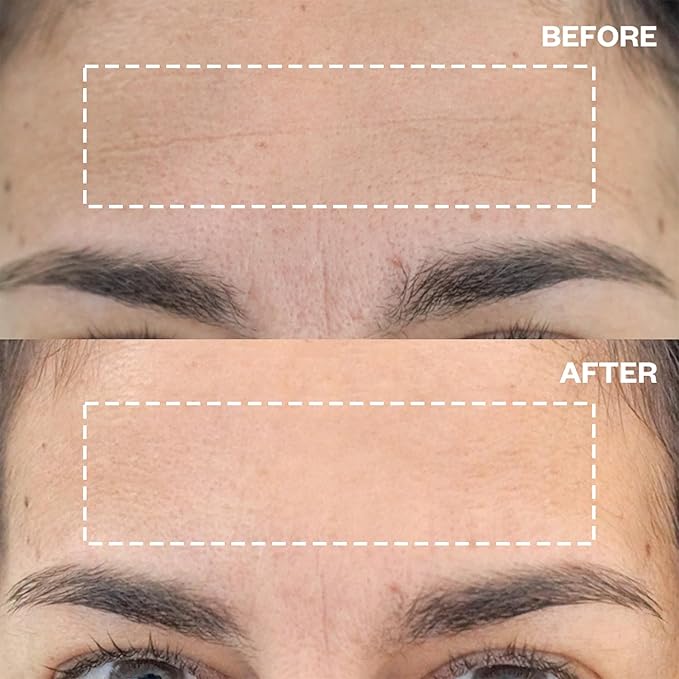 Wrinkles Schminkles Forehead Wrinkle Patches, 2-Pack, Reusable Hypoallergenic Silicone Smoothing Pads + Silicone Patch Cleanser 2 oz, Clean Silicone Patches Without Breaking Down The Adhesive-Velvo Beauty