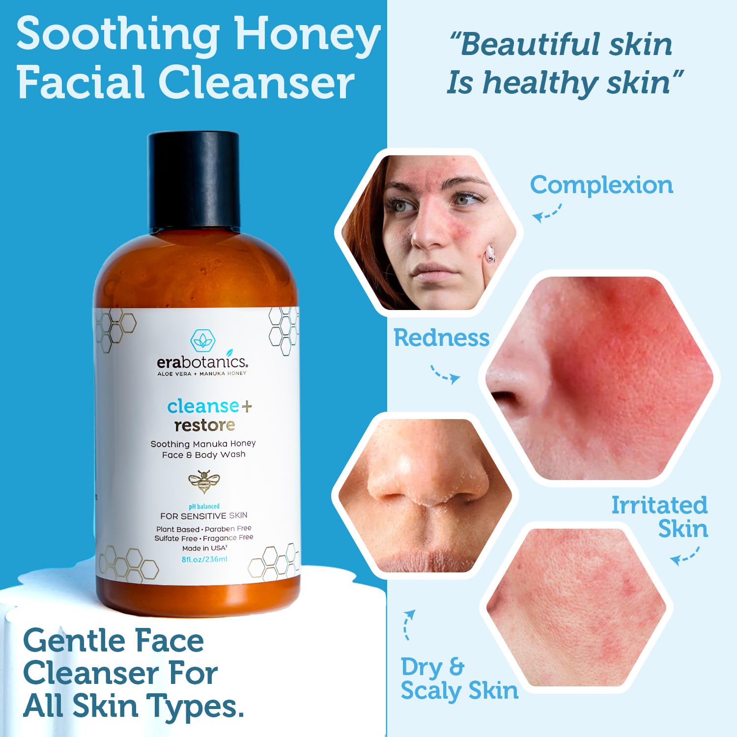 Manuka Honey Face Wash for Women and Men - Sulfate Free Moisturizing Cleanser with Organic Aloe Vera - Soothing Plus Gentle on Dry Skin Facial Cleanser Made in USA - 4oz-Velvo Beauty