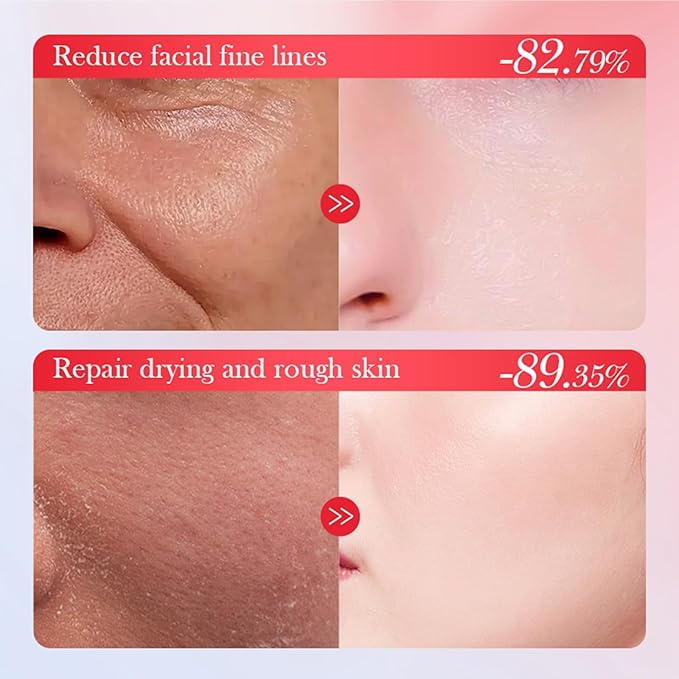 Goji Berry Skincare Sets, 6 In 1 Complete Facial Care Kit Antioxidant, Anti Aging Skin Care Set For Tighten, Lift & Reduce Wrinkles, Goji Berries Face Care Set For Women, Beauty Gift Set For Girls-Velvo Beauty