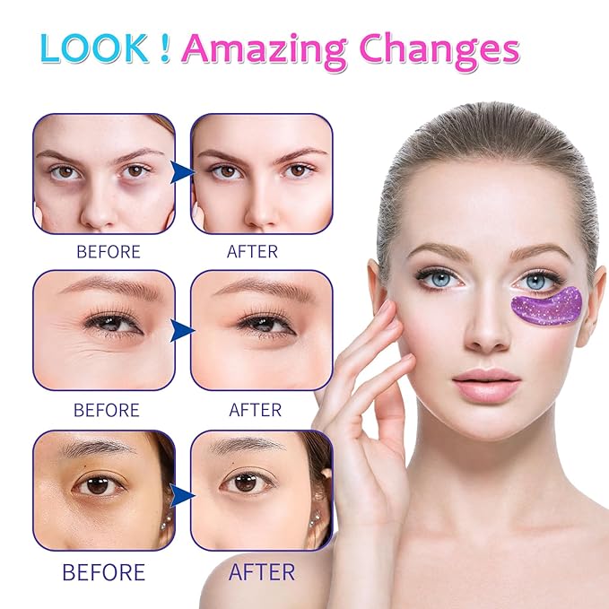 [ 28 Pairs ] Under Eye Patches, Eye Gel Mask for Puffy Eyes and Dark Circles with Natural Marine Collagen Reduce Wrinkles Anti-Aging Face Eye Skin Care Mask for Face,Puffiness, Eye Bags and Wrinkles-Velvo Beauty
