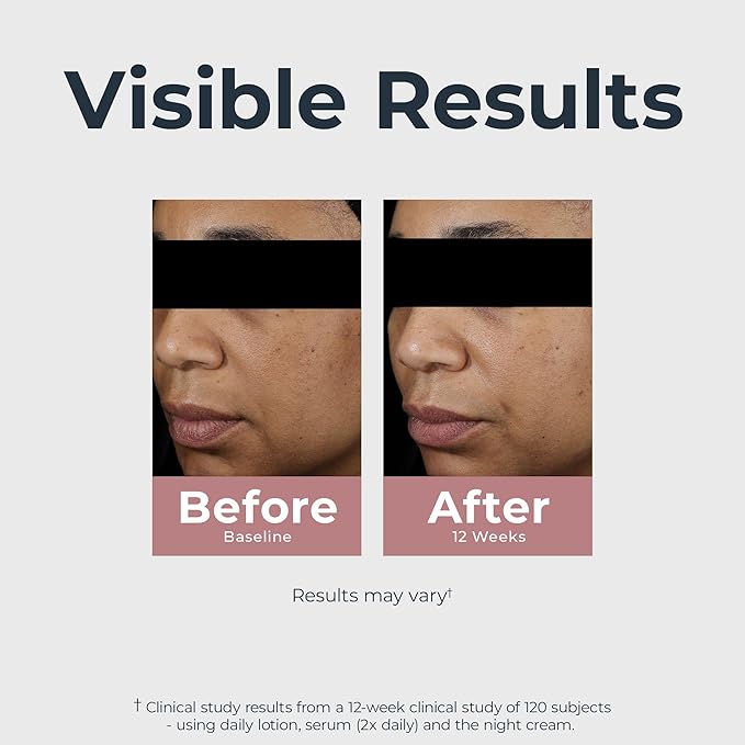 Eucerin Radiant Tone Night Cream, Dark Spot Corrector with Thiamidol, Night Moisturizer for Face Helps Visibly Reduce the Look of Persistent Dark Spots, All Skin Types, 1.7 Oz Bottle-Velvo Beauty