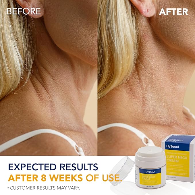 Korean Neck Cream for Firming & Tightening: Neck & Chest Anti-Aging Treatment for Crepey Sagging Skin & Wrinkles-Velvo Beauty