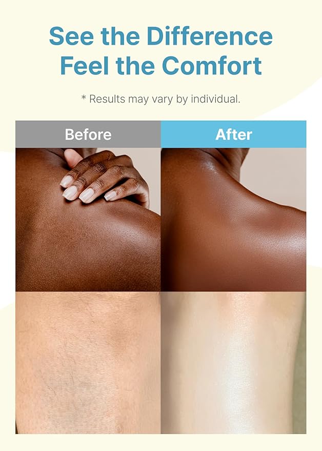 Derma B | Daily Moisture Body Oil | 99% Natural Argan & Sweet Almond Oil | Shower Oil for Dry Sensitive Skin | Light & Long-Lasting Hydration | Skin Body Care Oil with Peach Scent | 6.78 fl oz (200ml)-Velvo Beauty