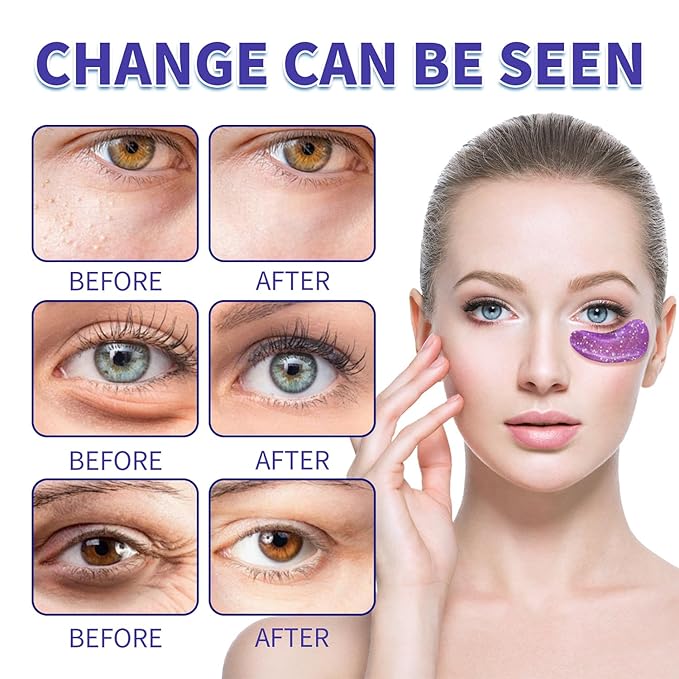 Under Eye Patches (28 Pairs), Eye Mask for Dark Circles, Puffy Eyes, Eye Bags, Wrinkles, 7 Colors Crystal Gel Gold Eye Mask Patches, Eye & Lip Treatment Skin Care Products-Velvo Beauty