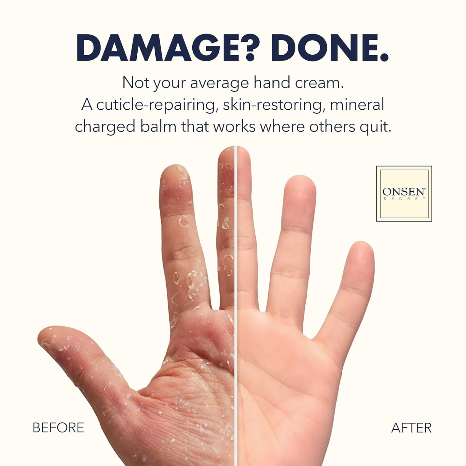 Onsen Hand & Cuticle Rescue Cream | Organic Nail Strengthener & Balm | Dry, Cracked Hands, Elbows & Feet | Shea Butter, Tsubaki & Jojoba Oil | Nail Repair & Growth, Vegan - 2 Pack (0.88 oz)-Velvo Beauty