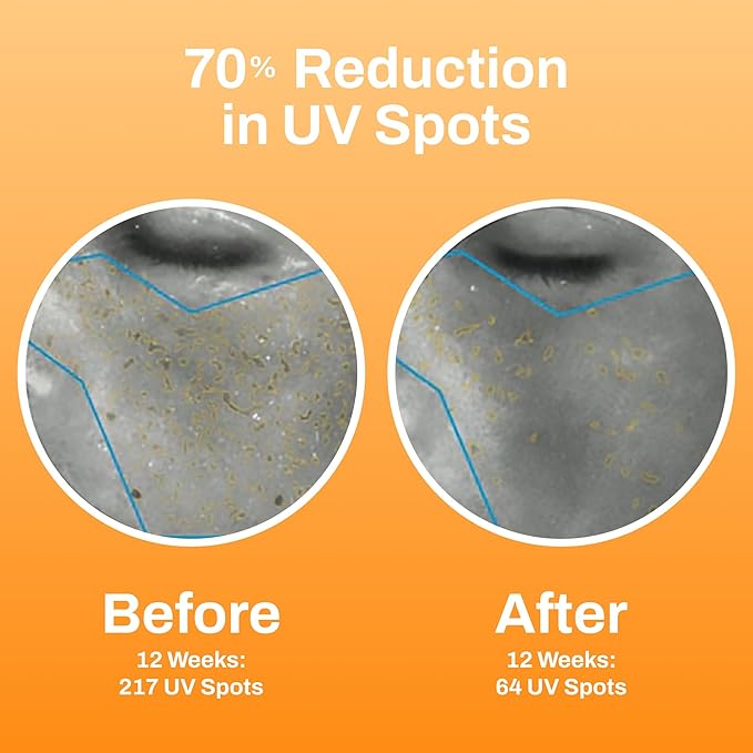 Photozyme GFS Plus Night Serum with 0.3% Retinol and Bakuchiol – Gentle Anti-Aging Peptide Formula – Reduces Wrinkles, Sun Damage & Dark Spots – Firms, Brightens & Smooths Skin – 1.7 fl oz-Velvo Beauty