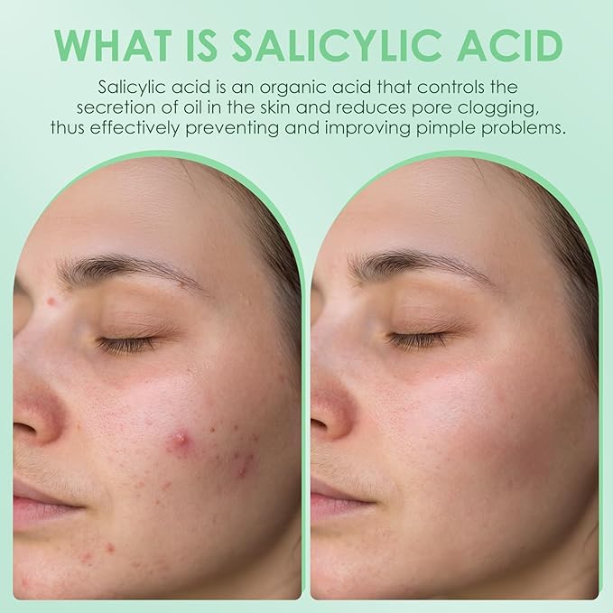 AUSLKA Salicylic Acid Oil Balancing Spray with 2% Salicylic Acid Regulates Skin Balance for Pimple and Oily Skin, Fruit Acid Spray for Face & Body (3.4 Fl Oz)-Velvo Beauty