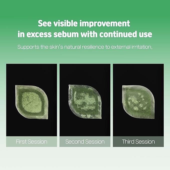 Cica Bio Spot Control Patch (1 Box, 62pcs) | Soothing Acne Patch for Redness & Blemishes | With Cica, Niacinamide & Tea Tree | Gentle for Sensitive Skin | Korean Skincare-Velvo Beauty