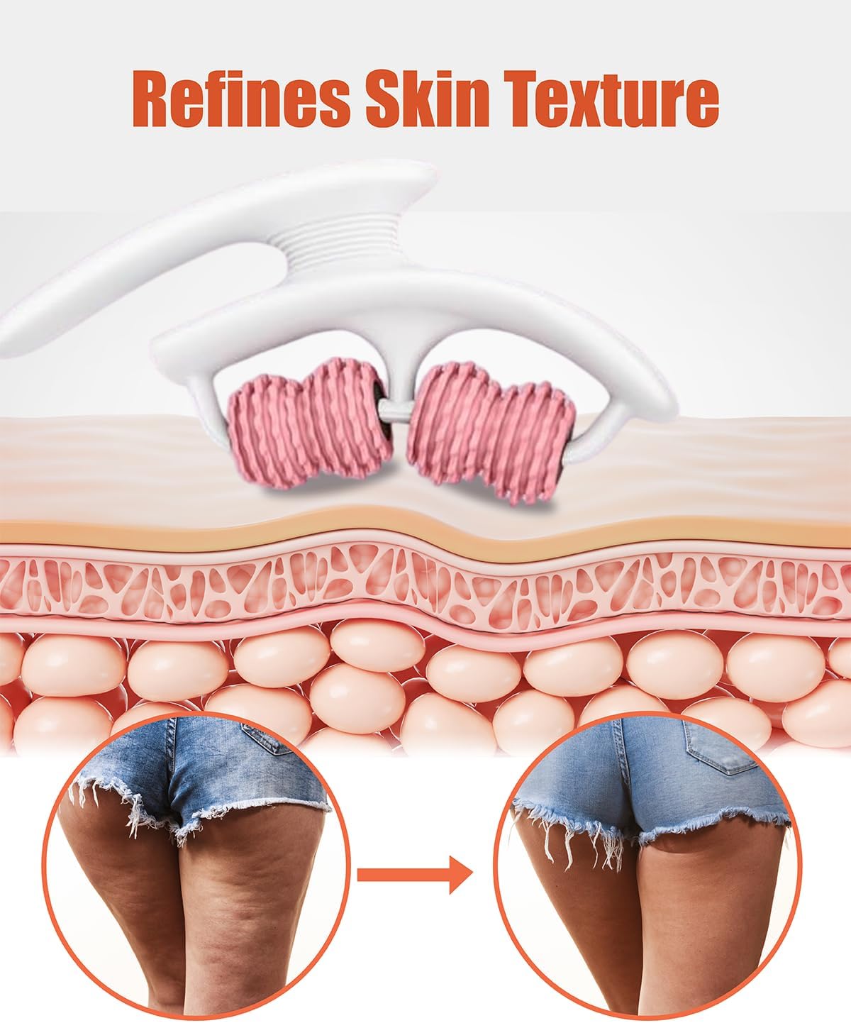 Cellulite Massage Roller - Anti-Cellulite Massager with Detachable Roller Handles for Thighs, Legs & Buttocks - Fascia Massage Tool for Lymphatic Drainage & Deep Tissue Therapy (Pink)-Velvo Beauty