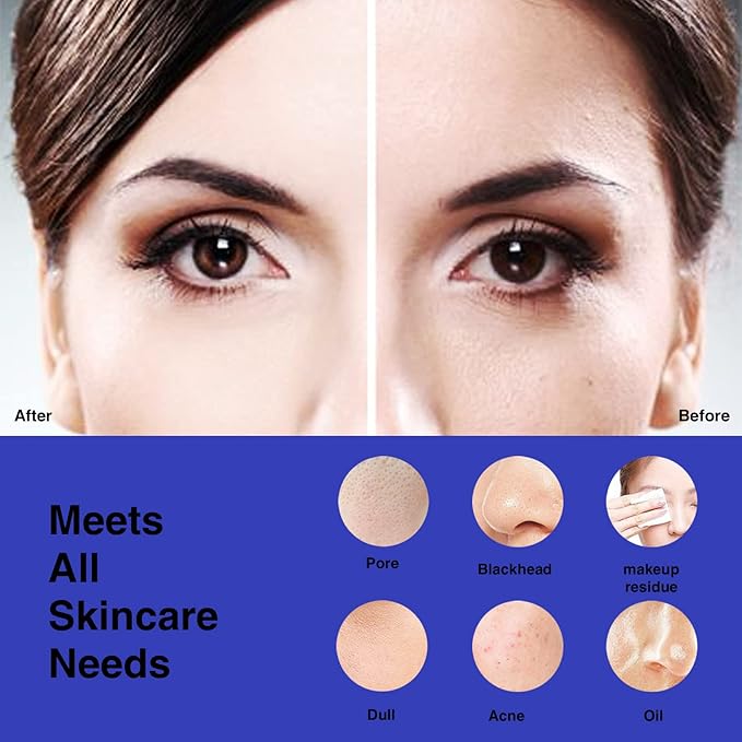 NågraCoola CLIE Facial Cleansing Brush, Waterproof and Rechargeable Face Scrub Brush for Men & Women, Cleansing, Exfoliating and Massaging, Electric Face Scrubber - Blue-Velvo Beauty