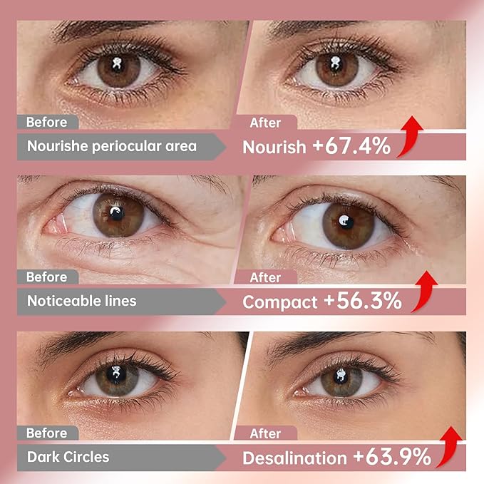 Novoy 7 Pairs Bio-Collagen Real Deep Eye Patches - 6-in-1 Retinol Overnight Eye Patches for Dark Circles, Puffiness & Wrinkles | 2% Caffeine+Hyaluronic+Niacinamide, Korean Popular Eye Mask - ROSE-Velvo Beauty