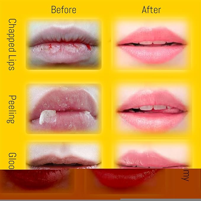 4PCS Lip Balm Honey Pot, Honey Pot Lip Balm for Dry Cracked Lips, Strawberry Lip Balm Scrubs Exfoliator & Moisturizer, Hydrating Lip Balm Honey Pot with Wand, Lip Sleeping Mask (4pcs)-Velvo Beauty