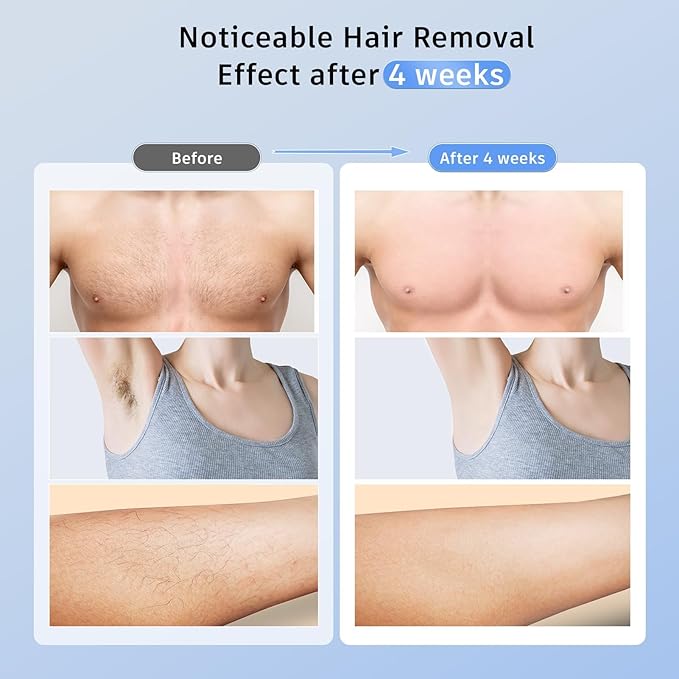 Painless IPL Laser Hair Removal Device with 5℃ Ice Cooling, 3-in-1 Permanent Hair Remover for Women & Men, At-Home Electrolysis Epilator for Face & Body Depilation (Gold)