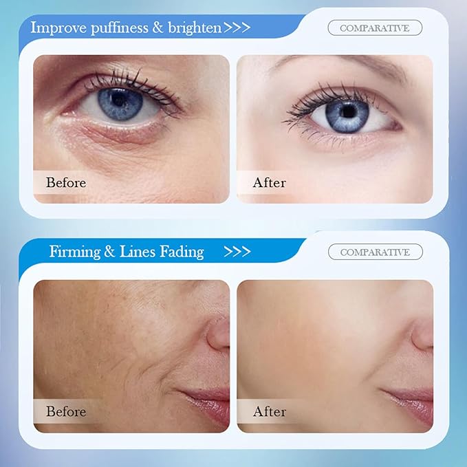 8D Hyaluronic Acid Face Care Set, Hydrating Skin Care Set Moisturize Skin, Smooth Fine Lines, Improves Skin Elasticity, Anti-Aging Skin Care Set with Cleanser,Eye Cream,Face Cream,Serum,Mask-Velvo Beauty