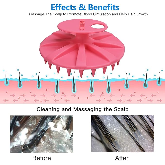 INNERNEED Scalp Massager Shampoo Brush, Wet & Dry Manual Scalp Care Head Scrubber Hair Washing, Soft Silicone Bristles, for Hair Growth, Dandruff Removal, Comfortable for All Hair Types (Pink)-Velvo Beauty