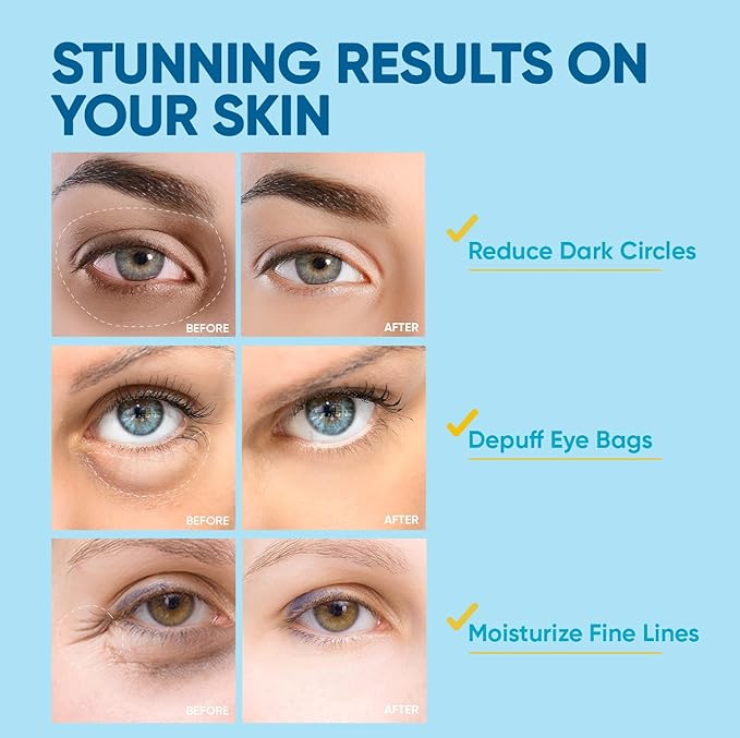 Under Eye Patches for Anti-Aging: 30 Pairs Retinol Collagen Gel Eye Pads - Reduces Wrinkles, Dark Circles, Eye Bags & Puffiness, Fine Lines Smoothing Treatment & Hydrating Eye Mask for Women-Velvo Beauty