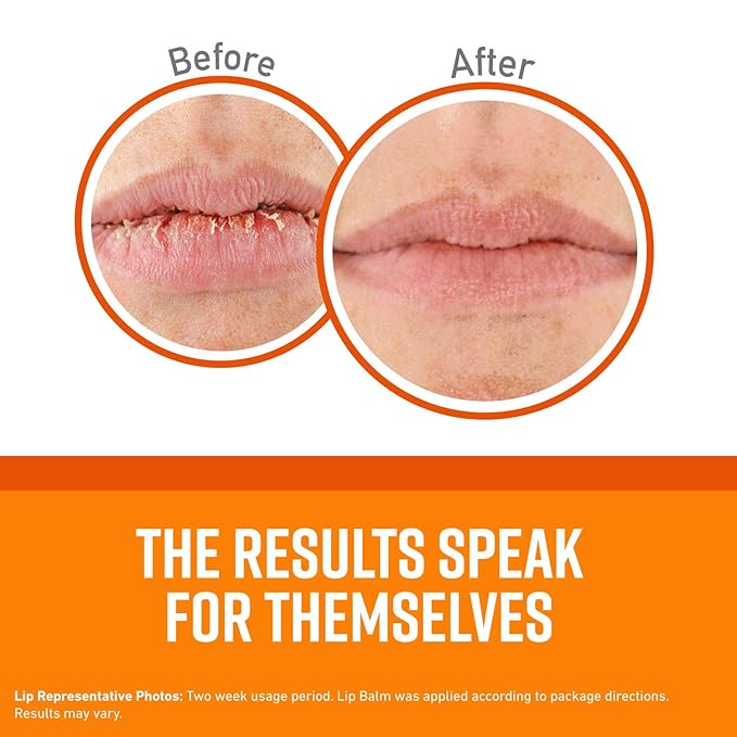 O'Keeffe's Unscented Lip Repair Lip Balm for Dry, Cracked Lips, Stick, (Pack of 12)-Velvo Beauty