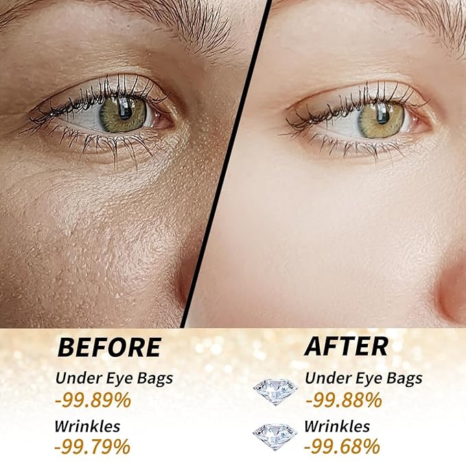 24k Gold Under Eye Patches - 60 Pcs Eye Mask Pure Gold Anti-Aging Collagen Hyaluronic Acid Under Eye Mask for Dark Circles, Puffiness & Wrinkles Refresh Your Skin-Velvo Beauty