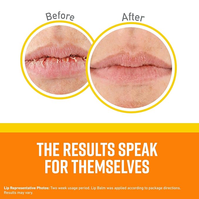 O'Keeffe's Lip Repair SPF 35 Lip Balm Stick, (Pack of 1)-Velvo Beauty