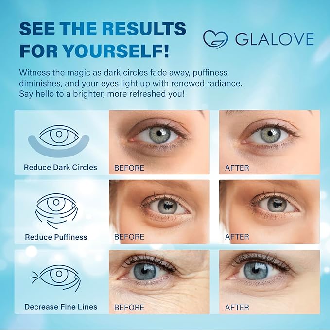 Under Eye Patches for Puffy Eyes: 60 Count Retinol Collagen Eye Gels Pads - Eye Skin Treatment Mask for Dark Circles, Wrinkles Puffy & Bags - Anti-Aging & Rejuvenating Eye Masks Women, Men (Blue)-Velvo Beauty