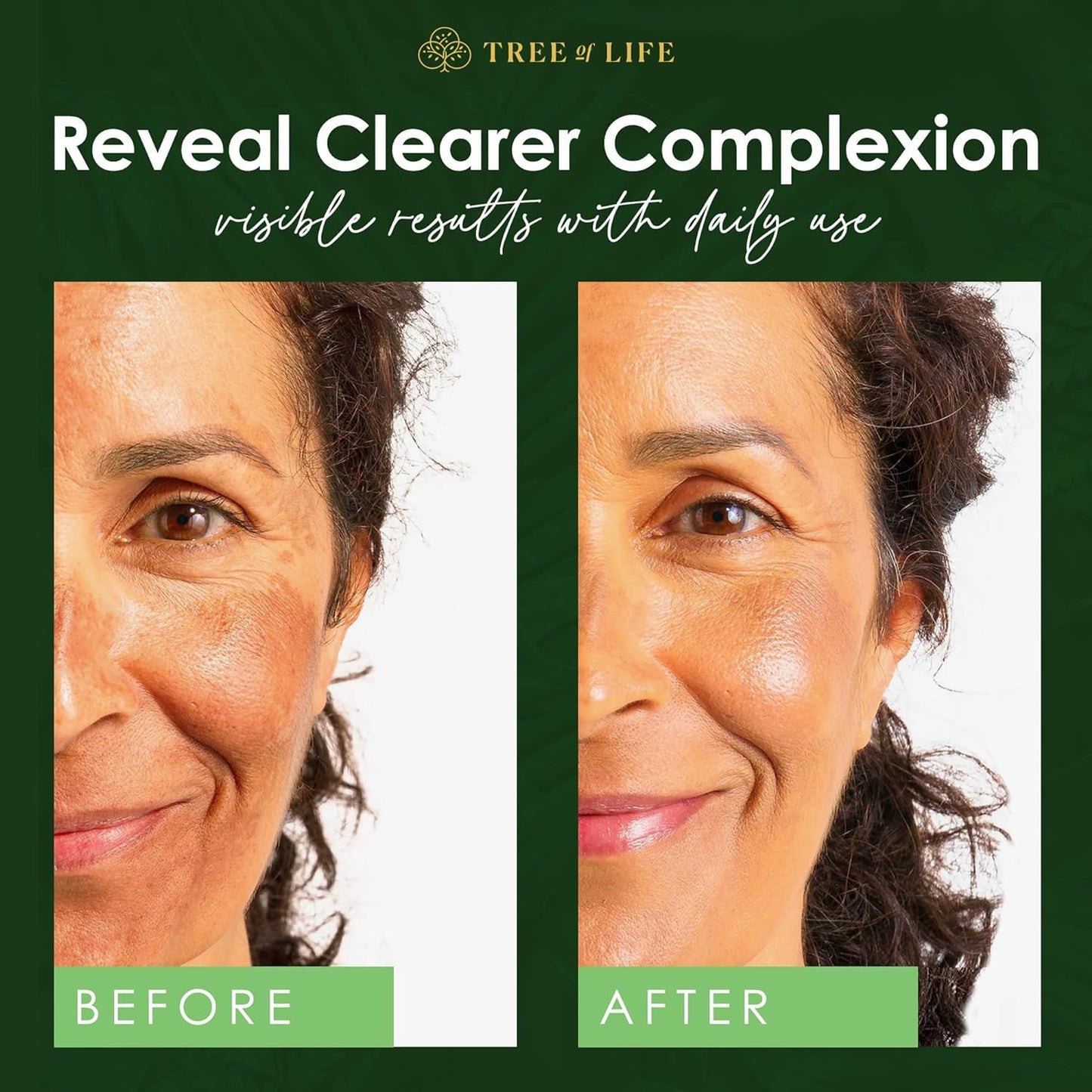 Tree of Life Beauty Niacinamide Vitamin B3 Serum, Hydrating Face Oil for Dark and Age Spots, Tightens Pores, Facial Serums for Sensitive Skin Care with Hyaluronic Acid and Vitamin E, 2 Fl Oz-Velvo Beauty