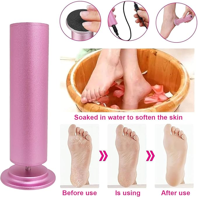 Electric Foot Callus Remover, Adjustable Foot Speed, Professional Foot Repair Tool, Equipped with 60 Pieces of Sandpaper, Suitable for Men and Women with Dead Skin calluses, Dry and Cracked, Pink-Velvo Beauty