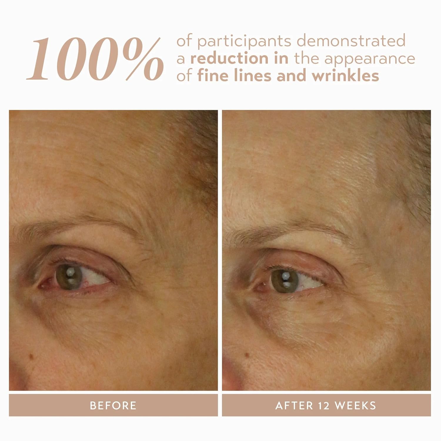 SHANI DARDEN SKIN CARE Retinol Reform with 1% Encapsulated Retinol Serum for Face & Neck, Gentle Slow-Release Face Serum with Tripeptide for Wrinkles, Fine Lines & Uneven Tone, 1 fl oz-Velvo Beauty