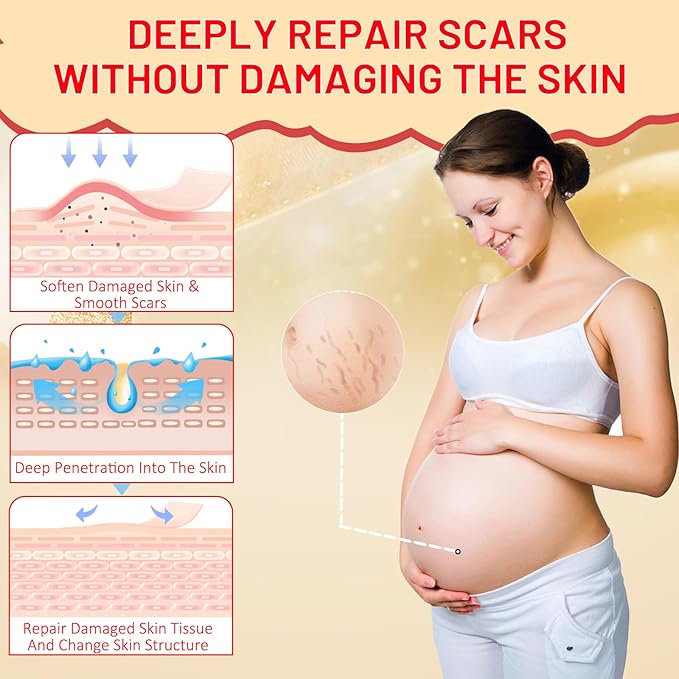 Stretch Mark Oil for Pregnancy, Skincare Body Oil for Scars and Stretchmarks, Pregnancy Oils for Stretch Marks Pre and Postpartum Natural Skincare Massage Oil, Skin Regenerate Oil, 4.2 fl.oz-Velvo Beauty