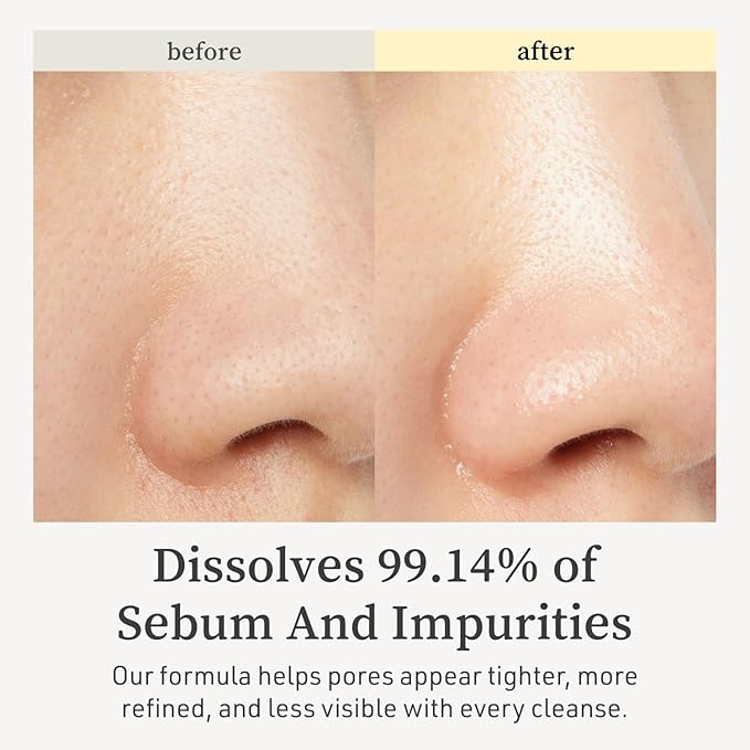 NOONI Facial Cleanser - Snow Aqua 0 LHA Toning Cleansing Oil | Makeup Blackhead Remover, Pore Control, Glass Skin, Help Control Sebum, Revitalizing, Moisturizing, Korean Skin Care, 6.76 Fl Oz (200 ml)-Velvo Beauty