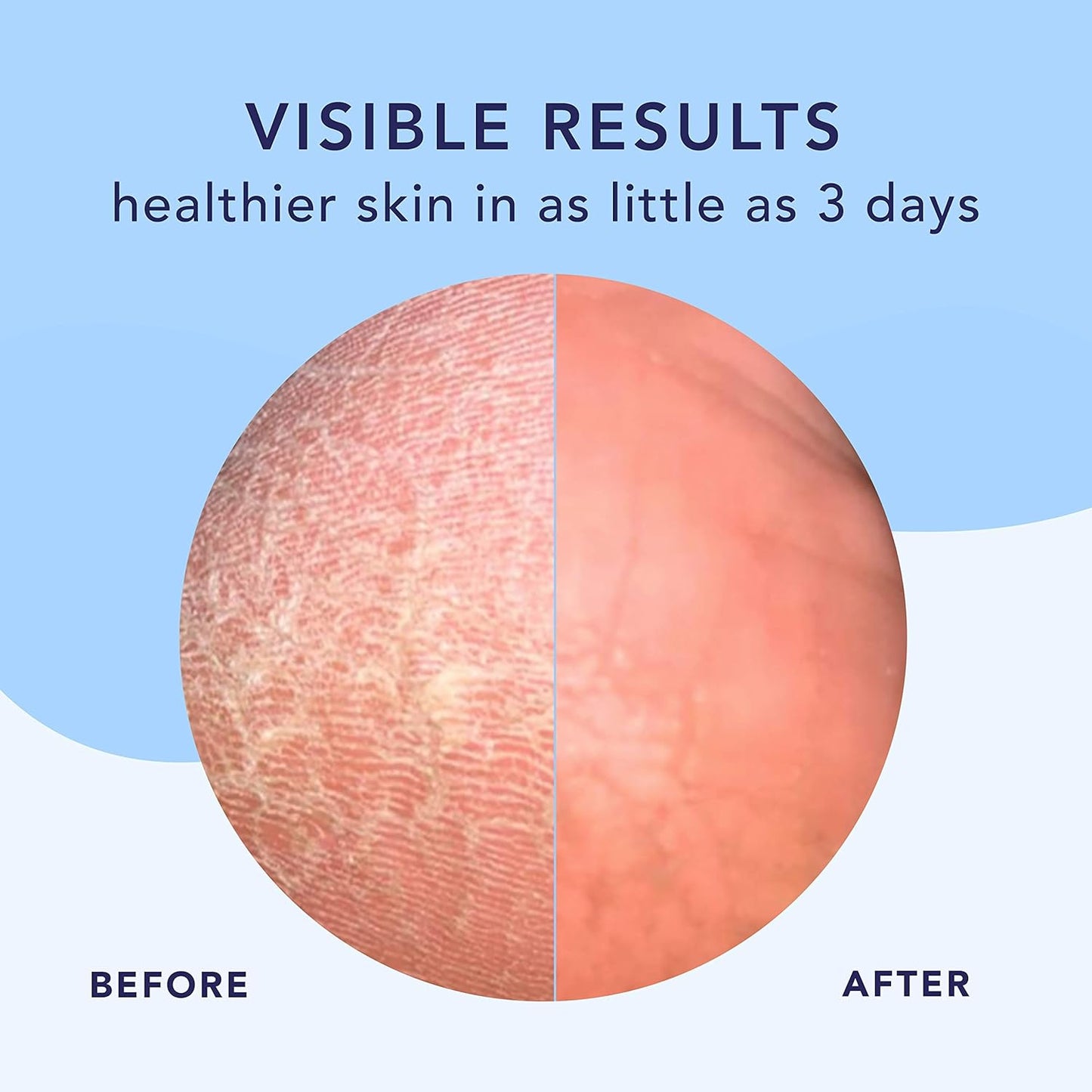 Barefoot Scientist High Dive Intensive Hydration Foot Therapy Cream, Specialized Moisture for Dry Feet and Cracked Heels-Velvo Beauty