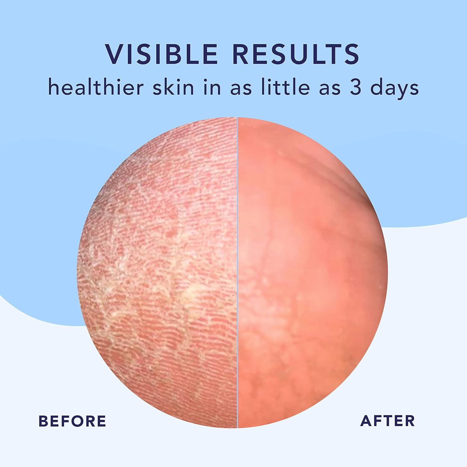 Barefoot Scientist High Dive Intensive Hydration Foot Therapy Cream, Specialized Moisture for Dry Feet and Cracked Heels-Velvo Beauty