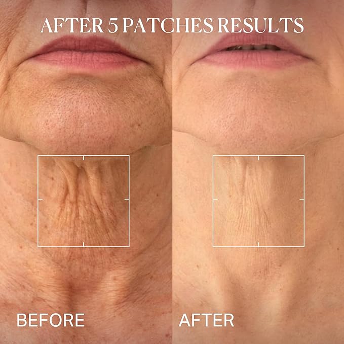 depology Tightening and Lifting Neck Wrinkle Patches with Cream, PDRN Deep Collagen Neck Mask, Firming Patch with PDRN、Collagen and Niacinamide Cream-Velvo Beauty