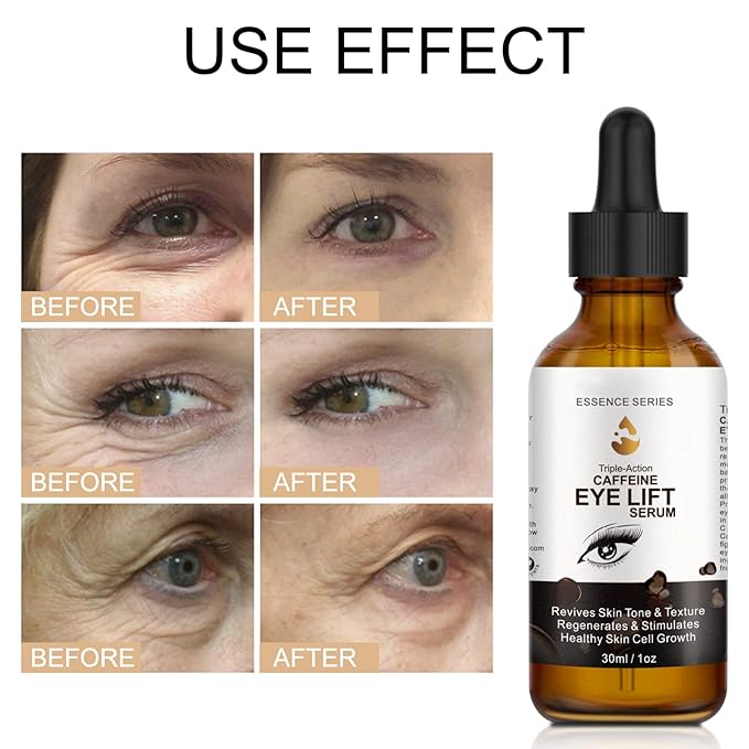 2 PCS Caffeine Eye Serum - Eye Cream for Dark Circles and Puffiness, with EGCG, Ascorbic Acid, Collagen, Caffeine Eye Lift Serum Reduces Under Eye Bags Wrinkles and Fine Lines- 2 oz/60 ml-Velvo Beauty