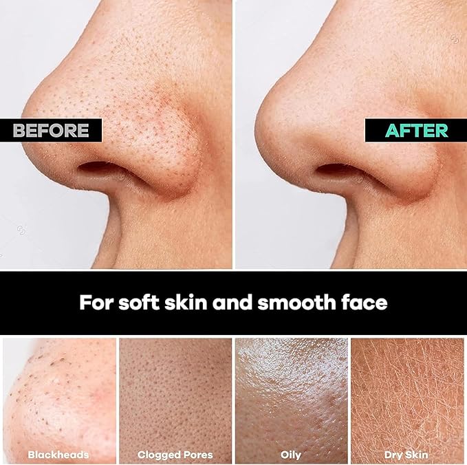 Dermasuri Deep Exfoliating Face Mitt - Scrubber, Dead and Dry Skin Remover for Men and Women - Exfoliator Gloves for Shower and Dry Use - ( 1 Pack)-Velvo Beauty