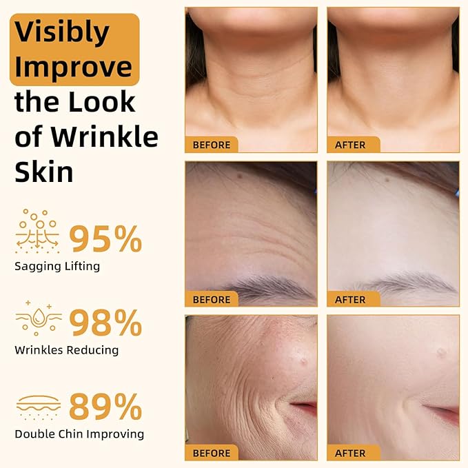 Bee Venom Firming Serum Stick, 2PCS Anti-Aging Face Cream, Lifts and Tightens the Skin, Hydrating, Lifting & Restoring Skin Elasticity, Bee Venom Body Tightening Cream for Women & Men-Velvo Beauty